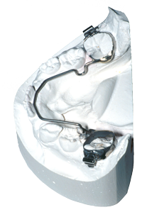 Les appareils orthodontiques - Ordre des technologues en prothèses et